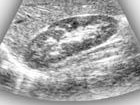 Ultraschall